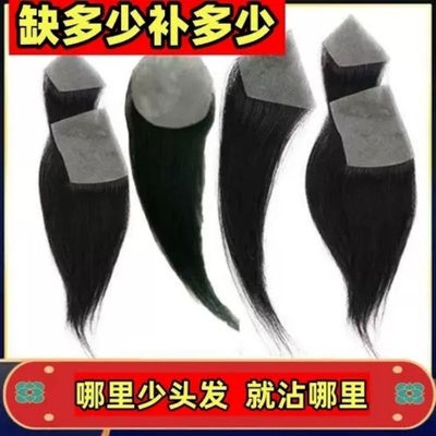 假发贴片疤痕补发贴无痕隐形假发男女补鬓角生物膜斑秃小面积发片