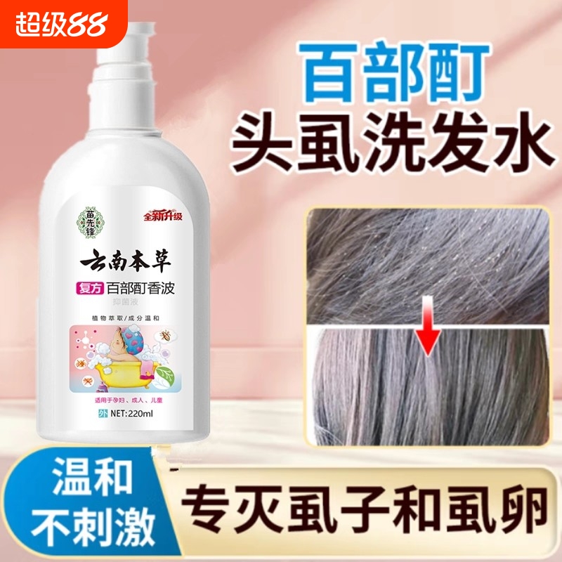 头虱洗发水百部酊虱子药小女孩虱立净去儿童头发头上除长的虱子卵