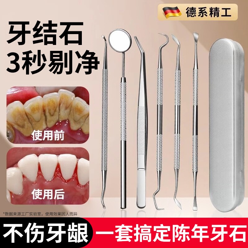 牙结石去除器牙齿清洁口腔镜子剔牙神器去污垢工具洁牙科牙垢牙石