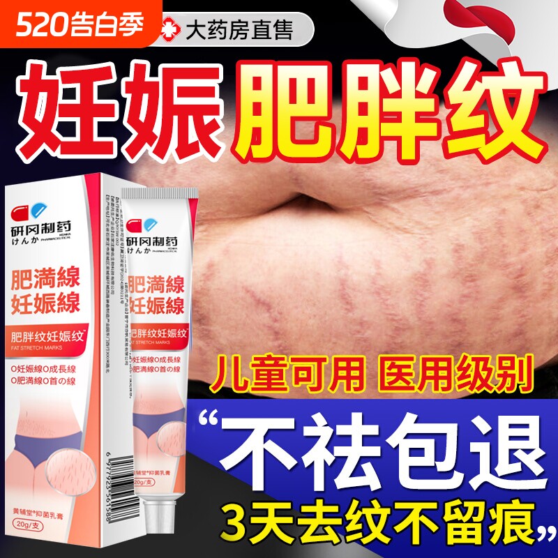 去妊娠纹肥胖纹修复霜生长纹消除学生男去紧致肚皮去除硅酮疤痕
