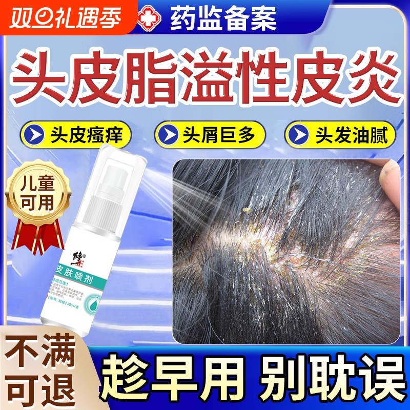 头皮毛囊炎喷雾剂头皮屑脂溢性皮炎药膏头部抑菌喷剂真菌感染头癣