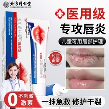 唇炎润唇膏嘴唇干裂脱皮唇膏保湿滋润去死皮口角炎医用修护膏专用