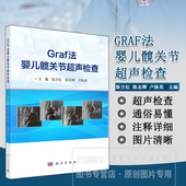 发育性髋关节发育不良简介 超声医学科医师 骨科医师参考用书 婴儿髋关节超声检查手术治疗方法文字简练 Graf法婴儿髋关节超声检查