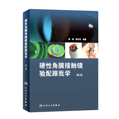 硬性角膜接触镜验配跟我学第二