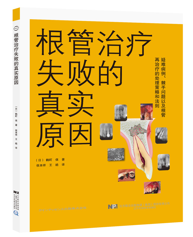 根管治疗失败的真实原因日鶴町保著侯本祥王皓译口腔修复正畸种植学医学类专业书籍图谱牙体牙髓病真正根尖周病变辽宁科技出版社