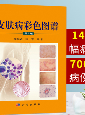 皮肤病彩色图谱 第4版 700余种皮肤性病科的常见病 多发病和一些少见病 疑难病 皮肤病学 虞瑞尧 漆军 9787030617637 科学出版社