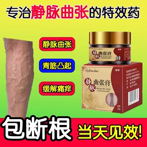 静脉曲张冷敷凝胶专特用效精索治蚯蚓小腿青筋凸起疗官方正品膏药