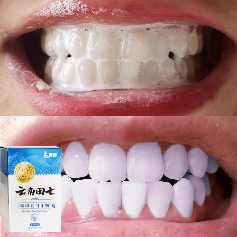 洗牙神器渍一擦即除黑色烟