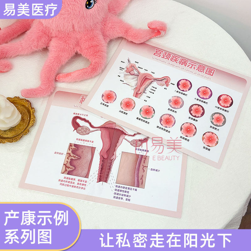 妇科宫颈私处疾病子宫生殖变化解剖图谱产康私密宣传纸页塑封医美