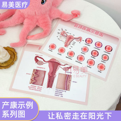 妇科宫颈私处疾病子宫生殖变化解剖图谱产康私密宣传纸页塑封医美