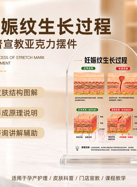 孕期妊娠纹科普亚克力桌牌皮肤弹性纤维讲解牌母婴护理宣教摆台科