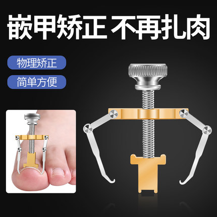 甲沟炎嵌甲矫正器沟脚嵌甲矫正器