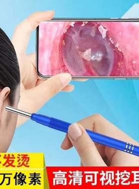可视采耳仪器耳道内窥镜掏耳朵神器耳科高清摄像电子耳镜探头儿童