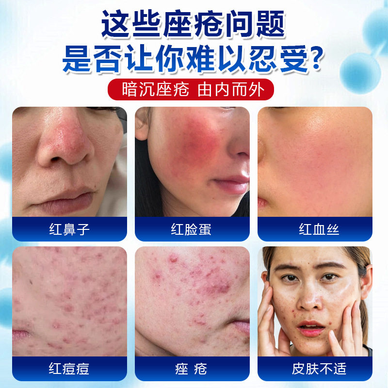 德国靡浩览娅玫瑰痤疮膏暗沉痤疮痘痘痘坑痘印膏护理膏清洁膏,家庭/个人清洁工具,洗漱包,淘宝优惠券,粉丝福利购,淘宝优惠卷