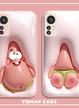 适用小米17promax/14Pro情侣手机壳新款13派大星civi闺蜜11ultra红米k70高级感note12turbo网红k60卡通可爱10