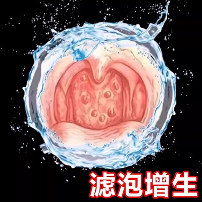 【云南本草】一喷喉咙舒适喷剂