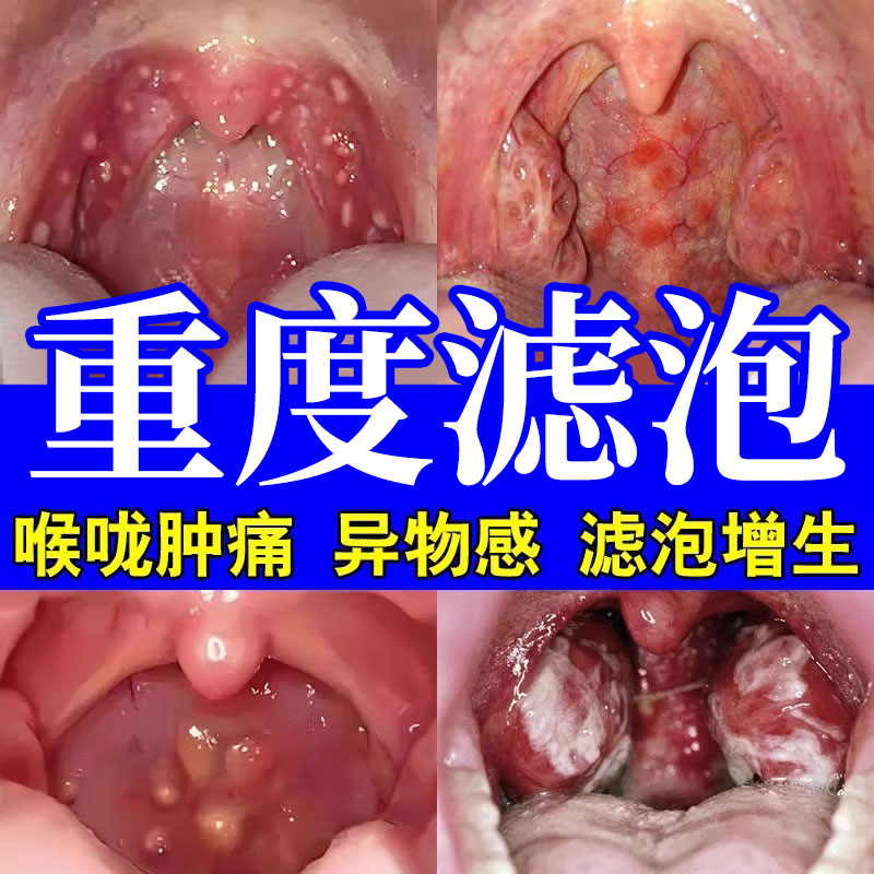 【云南本草】一喷喉咙舒适喷剂