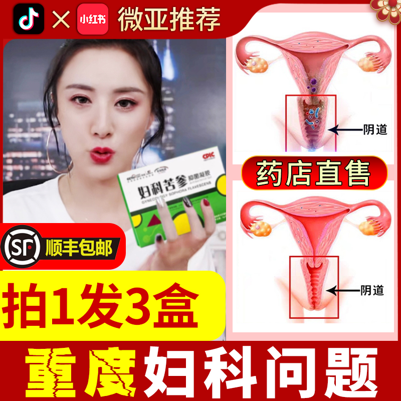苦参凝胶私处护理抑菌阴道宫颈烂糜用药霉菌性阴炎韆金妇科炎症ZK