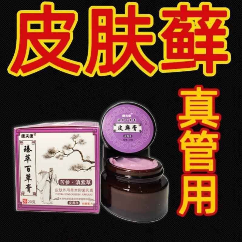 特效药荨麻疹头部头癣老偏方银霄病神经性皮炎过敏苗家