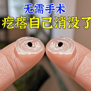 美國正品 皮下鼓包全身可用草本鼓包涂抹膏 胖東淶銷冠王
