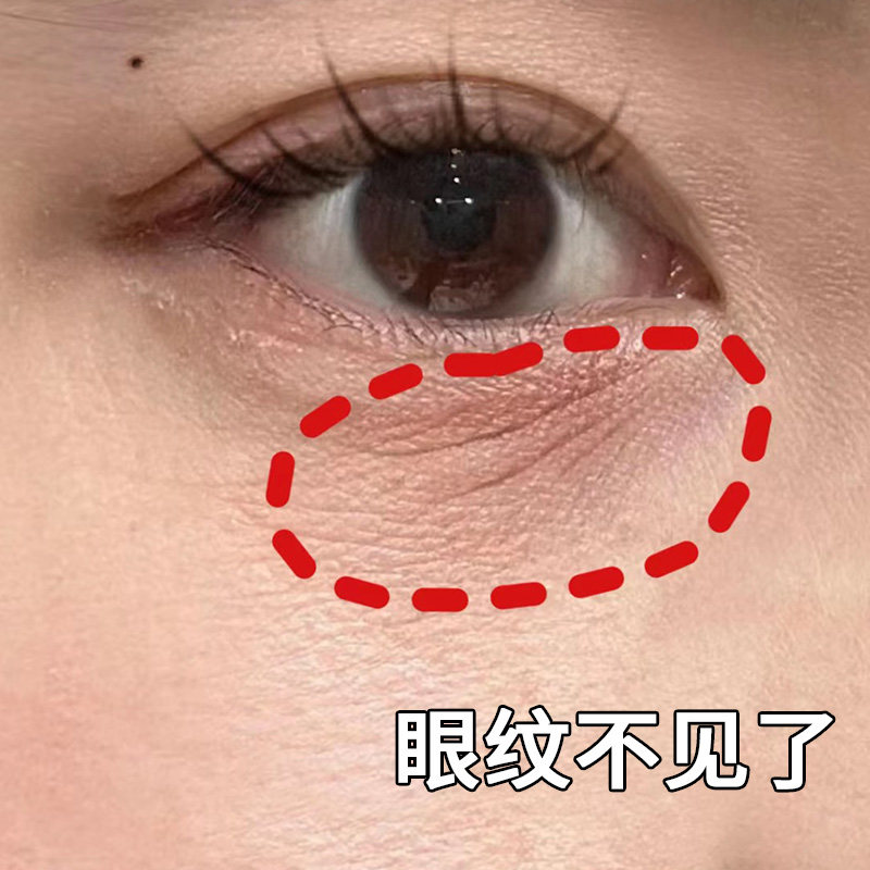 【小红书推荐】再见眼角纹 睡前涂上它 淡化黑眼圈 眼部精华素