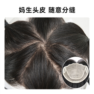 秃头宝贝真发自然假发片女遮盖发缝宽尖头辫发补发片递针头皮分缝