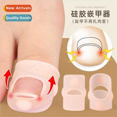 Ingrown Nail Corrector Ingrown Nail Corrector Ingrown Nail C
