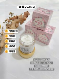 正品南澳古方珍珠膏痘痘亮白淡痘印斑祛黄嫩肤提亮肤色网红同款