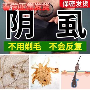 百甘白甘堂去阴虱螨虫正牌篮标蓝标湿虱疥康芝夫芙肤喷剂 正品