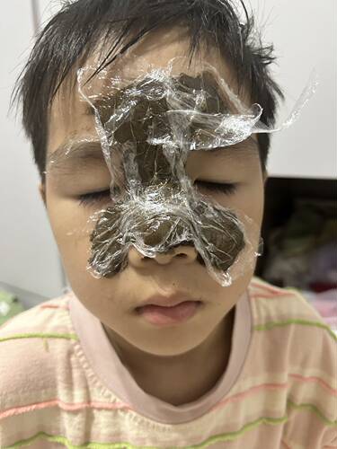 凯撒熊刘宁堂鼻疗体验装5次
