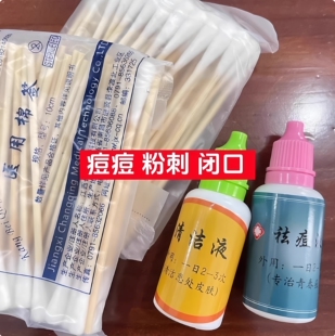 杭州医院 痘痘 粉刺 闭口【草本提取液】每日2-3次,效果极好
