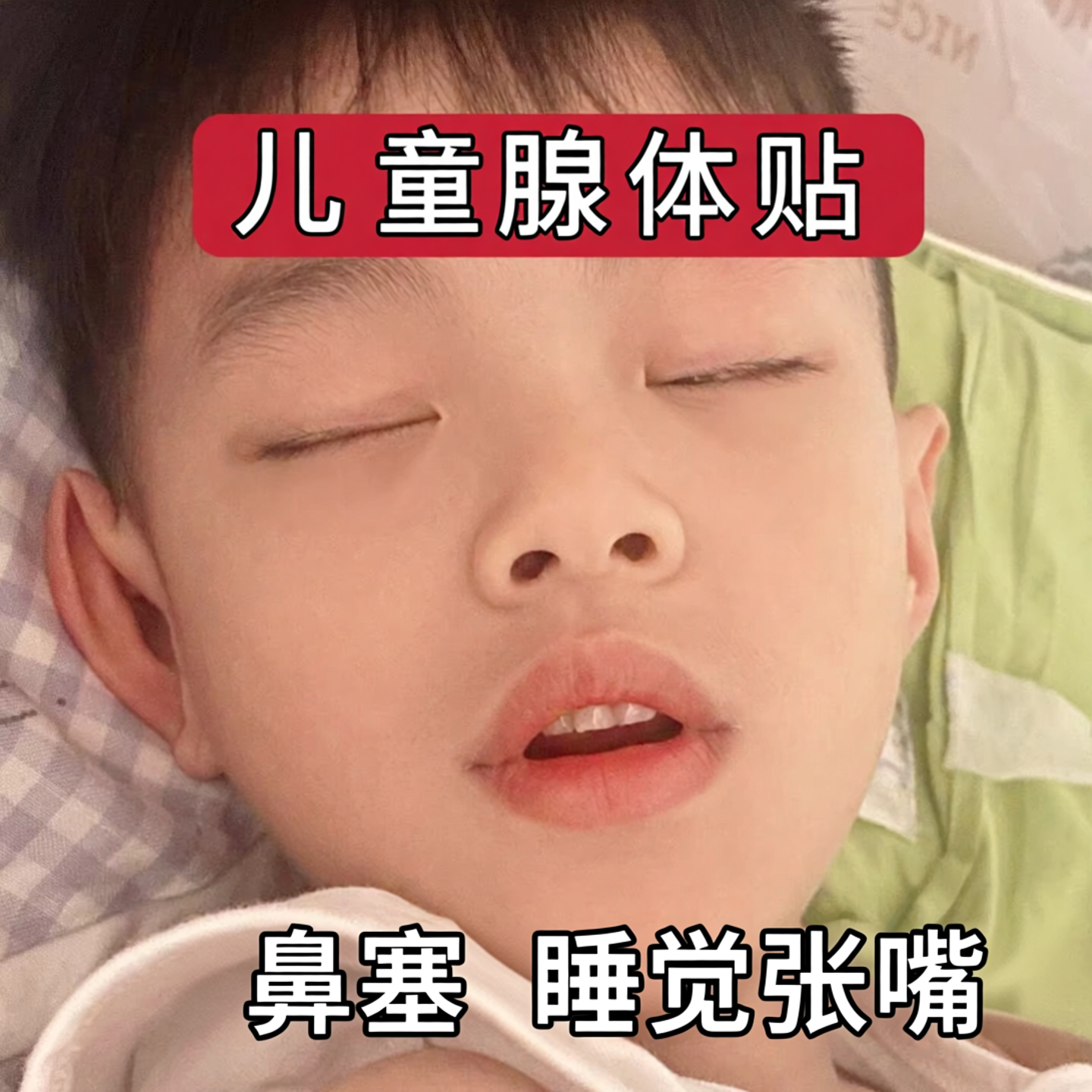 杭州医院【儿童腺体贴】宝宝鼻塞 呼噜 睡觉张嘴