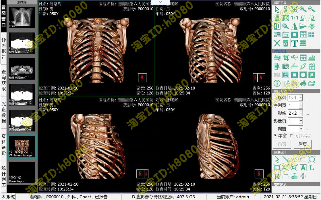 CT工作站软件CT报告软件DR工作站软件CR工作站软件MR软件