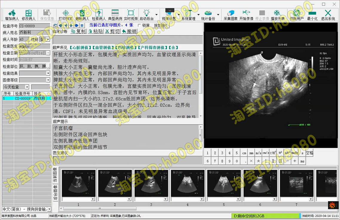 新索图超声软件索图B超软件四维彩超索图彩超软件加密狗win7win10 3C数码配件 其它配件 原图主图