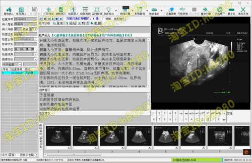 超声软件，彩超工作站，B超报告