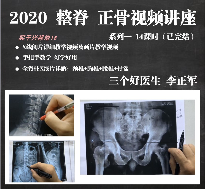2020三个好医生正骨教学美式整脊视频x线脊柱颈胸腰读片