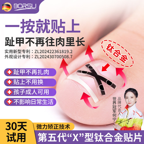 ->【一贴就好】新款X型甲沟矫正