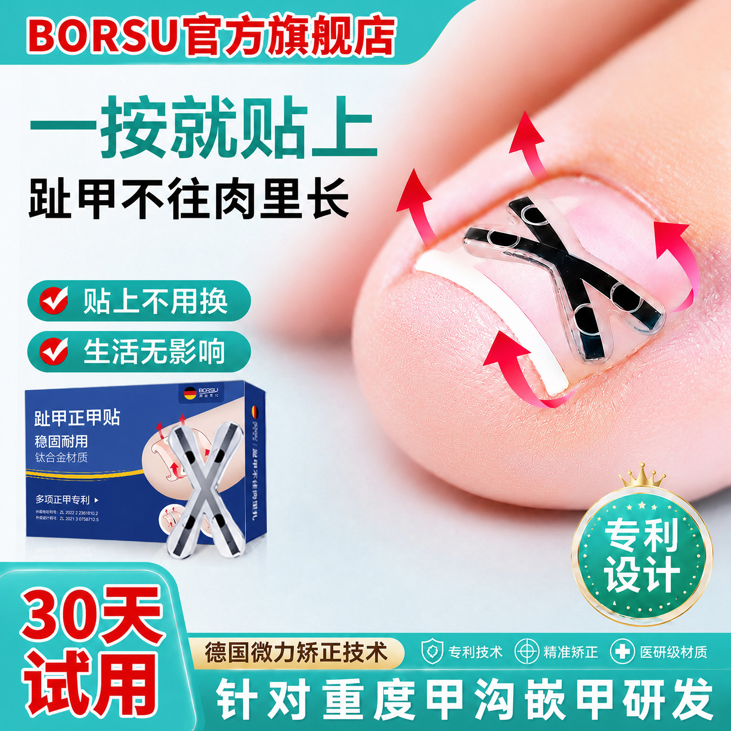BORSU德国重度甲沟嵌甲炎专用矫正器正甲贴片脚趾指甲肉里长刀剪