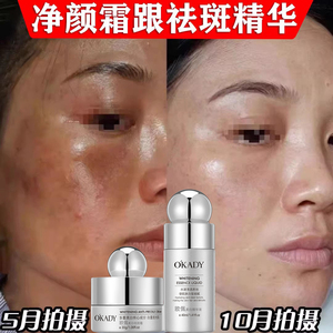 羽西研净颜霜跟祛斑精华液希妍淡斑正品官方旗舰店祛斑分解黑色素