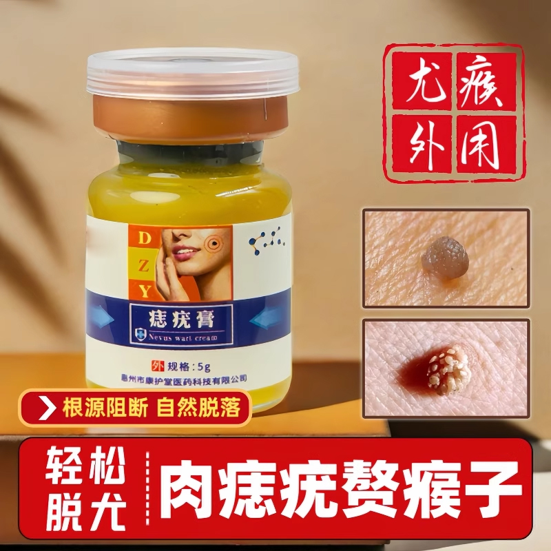 去肉痣皮赘扁平瘊除膏脖子