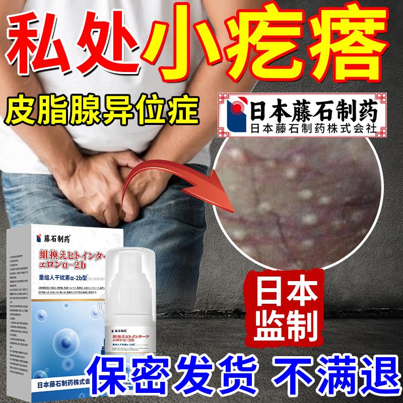 阴茎阴囊小疙瘩皮脂腺异位症包皮阴囊潮湿瘙痒增生囊肿药监备案HV