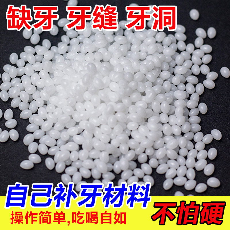 补牙齿洞膏补牙缝修复蛀牙自己在家填牙洞填充剂清理神器临时家用