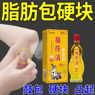 脂肪疙瘩膏身上有鼓包大小硬块改善凸起皮下硬肿块凹凸不平专用油