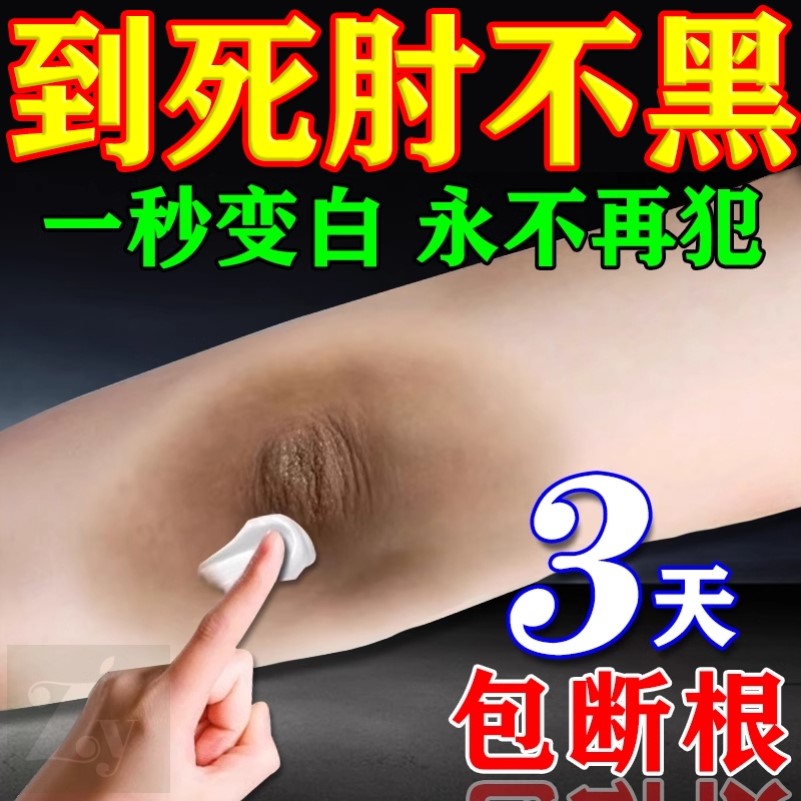 胳膊肘去黑去死皮去黑色素沉淀手肘全身皮肤黑磨砂膏药膏变白神器
