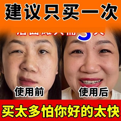 面瘫药膏贴脸部训练神器热敷专用牵正后遗症恢复眼皮痉挛