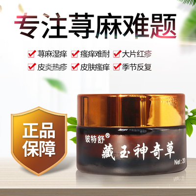 荨寻麻疹过敏止痒药膏阴囊瘙痒顽固湿男人下身蛋蛋痒大腿内侧瘙痒