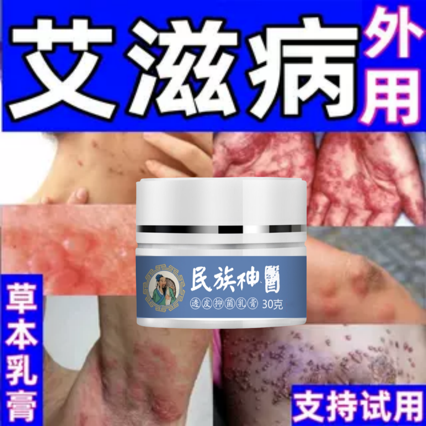 治艾滋病外用药病毒感染疱疮丘疹瘙痒止痒急性黏膜湿疣皮藓乳膏