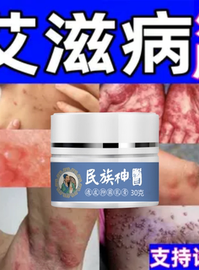 治艾滋病外用药病毒感染疱疮丘疹瘙痒止痒急性黏膜湿疣皮藓乳膏
