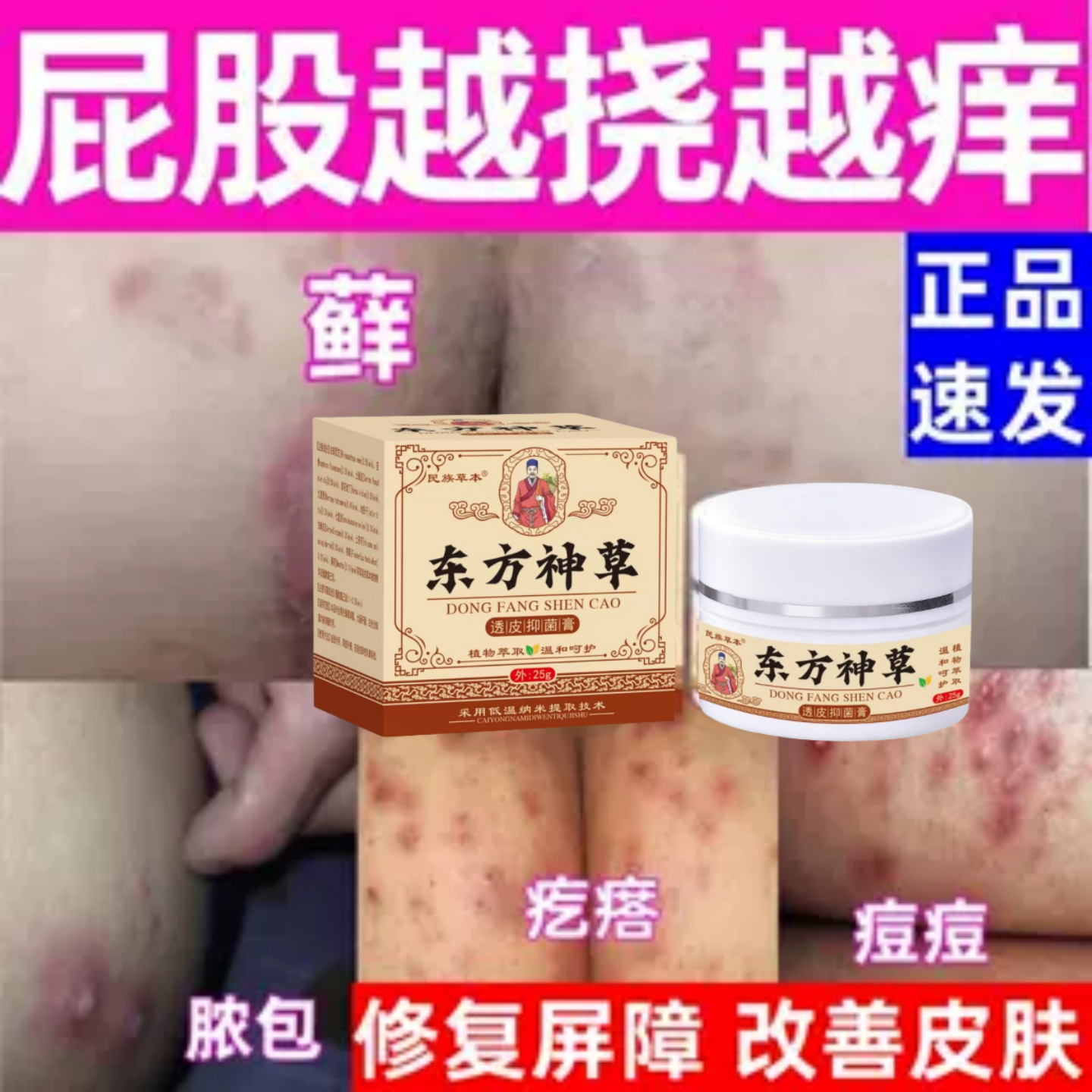 屁股长疙瘩久坐脓包股藓屁眼瘙湿痒去消除止痒快克抑菌修复膏