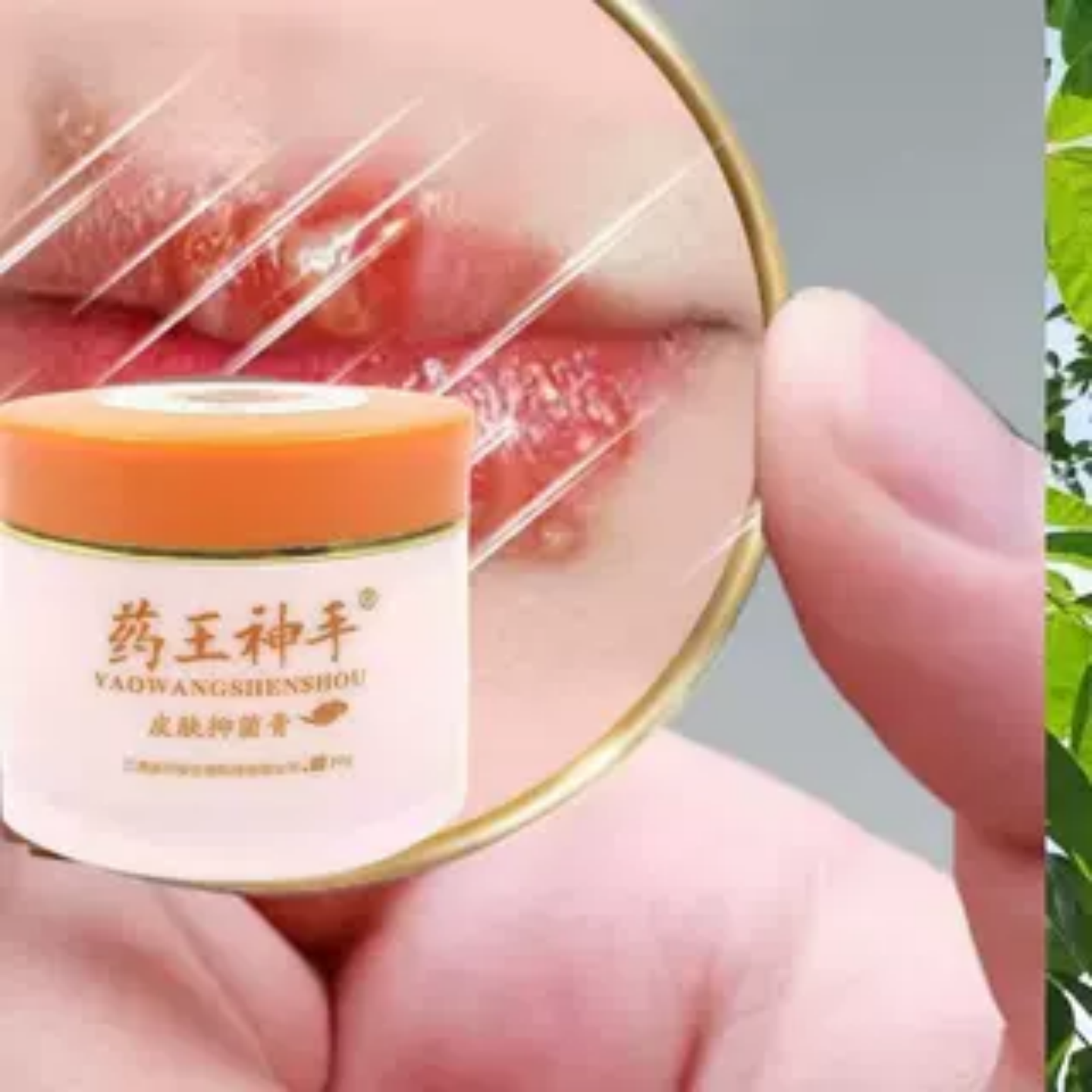 唇炎疱疹嘴唇角嘴巴红肿糜烂药膏